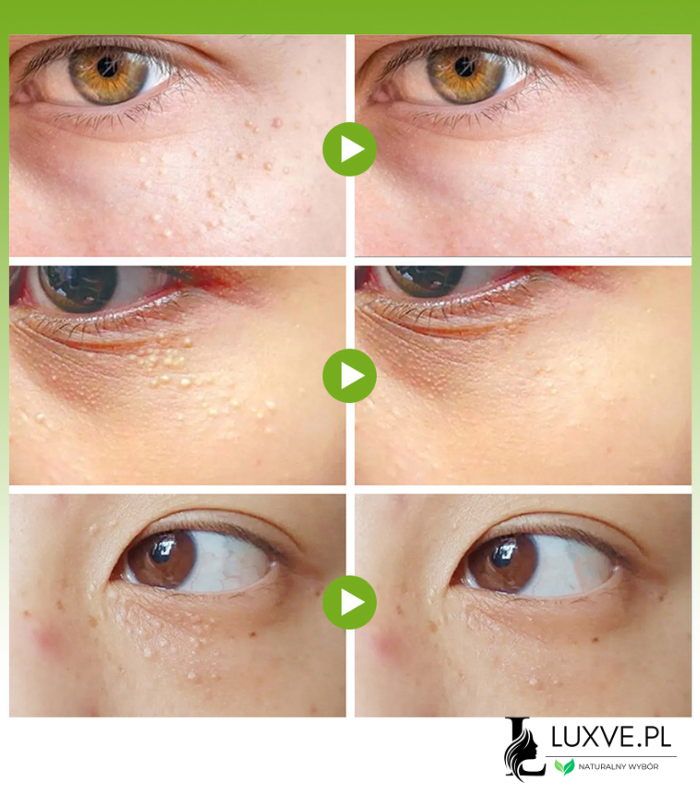 KREM NA PROSAKI I KASZAKI POD OCZAMI Z WITAMINĄ E 20G PIELĘGNACJA SKÓRY LUXVE